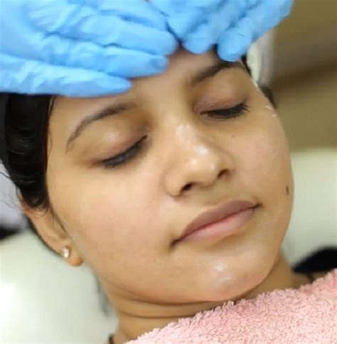 Uneven Skin Tone Treatment Delhi India Satya Skin