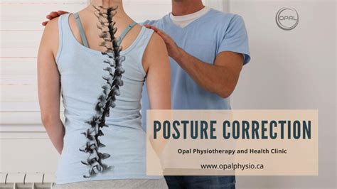 posture correction physiotherapy opal physio 2022