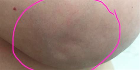 To choose the best food processo. This Woman Shared A Picture Of Her Breast So You Can See