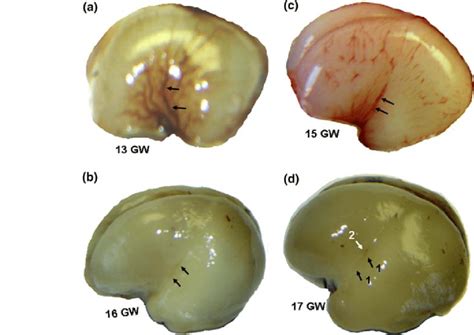 Photographs Of The Lateral View Of The Fetal Brain At 13 15 16 And 17