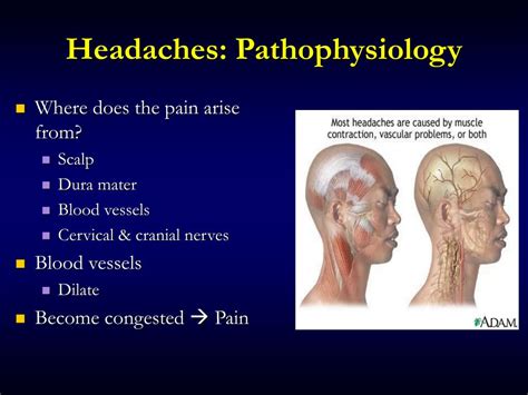 Ppt Headache And Facial Pain Powerpoint Presentation Free Download