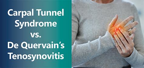 Carpal Tunnel Syndrome Versus De Quervains Tenosynovitis Irg