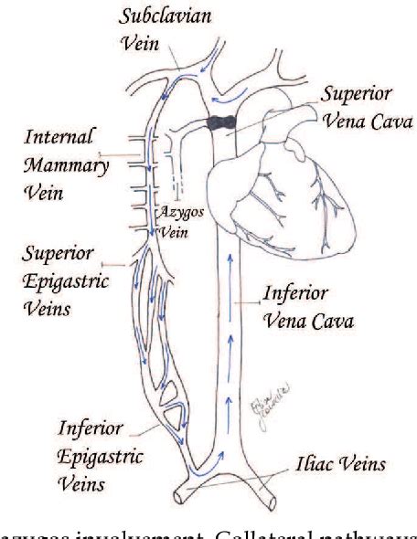 Superior Vena Cava Anatomy