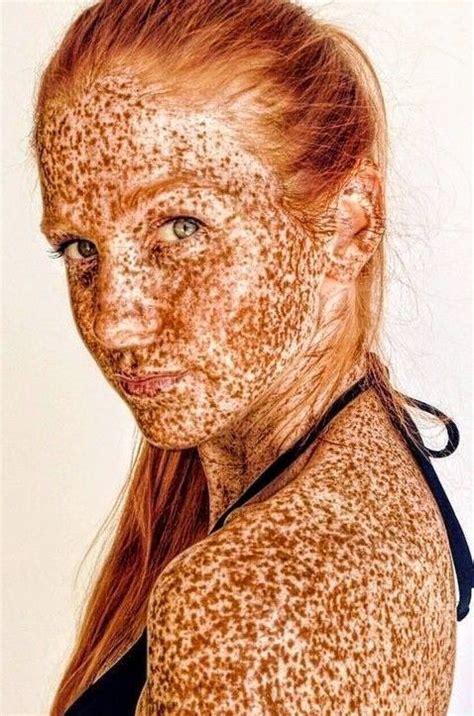 Pin By Troy Gillette On Beautiful Redheads Red Hair Freckles