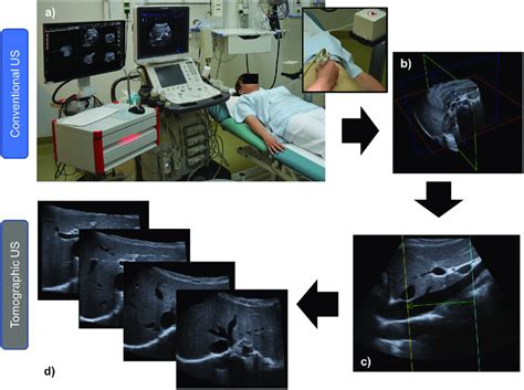 Acquisition Of Tomographic Ultrasound Conventional Ultrasound