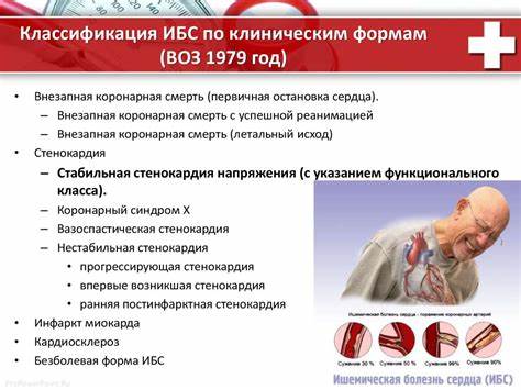 Ибс стенокардия напряжения диета Стабильная стенокардия напряжения - презентация онлайн Стабильная стенокардия напряжения - презентация онлайн Ибс стенокардия напряжения диета