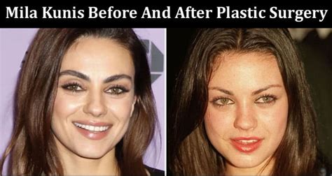 Mila Kunis Before And After Plastic Surgery Has Mila Kunis Get