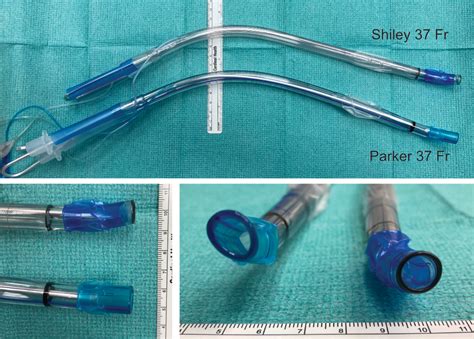 Tracheobronchial Trauma From Double Lumen Tube Placement In Patients