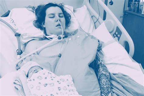 25 Year Old Gives Birth In Coma After Brain Avm Diagnosis Bleed