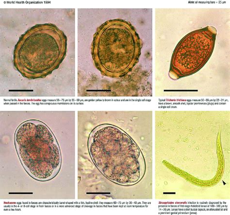 Some Of The Parasites That Can Be Found In Stool Test Download