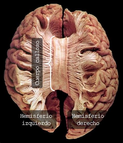 Anatomía Del Cerebro Asociación Educar Para El Desarrollo Humano