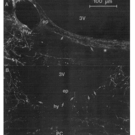 dark field photomicrographs illustrating dflh positive axons in download scientific diagram