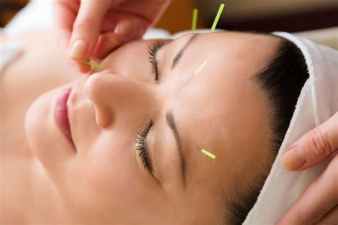 Cosmetic Acupuncture Coming Soon
