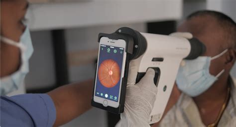 Icymi Smartphone Based Fundus Camera Provides Option For Glaucoma