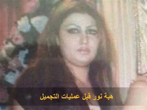 هل تبدلت ملامحها؟ سميرة سعيد تكشف أسرار انفصالها مرتين وتعرضها للتحرش: هبة نور قبل عمليات التجميل وبعد - YouTube