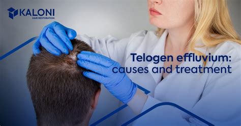 What Is Telogen Effluvium Causes And Treatment
