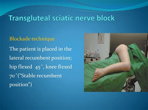 Sciatic Nerve Block Landmarks Figure 2 From Ultrasound Guided Sciatic