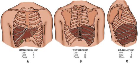 Rib cage, in vertebrate anatomy, basketlike skeletal structure that forms the chest, or thorax, and is made up of the ribs and their corresponding attachments to the sternum (breastbone) and the vertebral column.the rib cage surrounds the lungs and the heart, serving as an important means of bony protection for these vital organs.in total, the rib cage consists of the 12 thoracic vertebrae and. Has the liver always been completely behind the rib cage ...