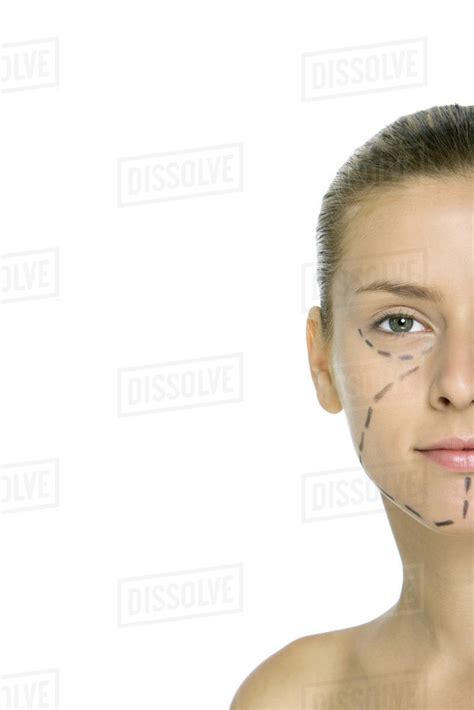 Woman With Plastic Surgery Markings On Face Looking At Camera Cropped