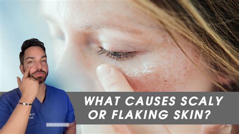 What Causes Scaly Or Flaking Skin Recipe Ideas Product Reviews And