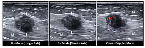 Diagnostics Free Full Text Ultrasound Imaging Of Abdominal Wall