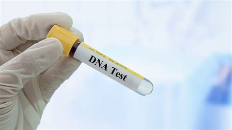 Five Things You Need To Know Before You Take A Home Dna Test