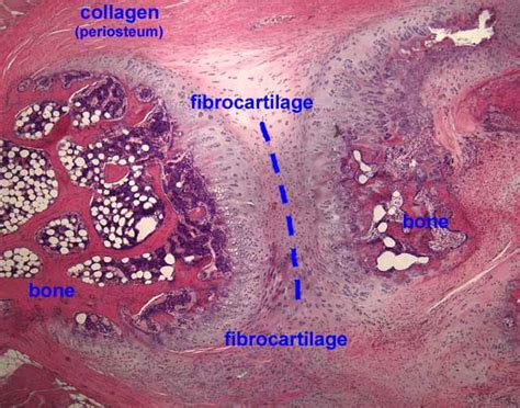 Fibrocartilage Histology