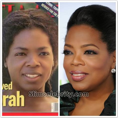Oprah Winfrey Nose Job Plastic Surgery Before And After Star Plastic