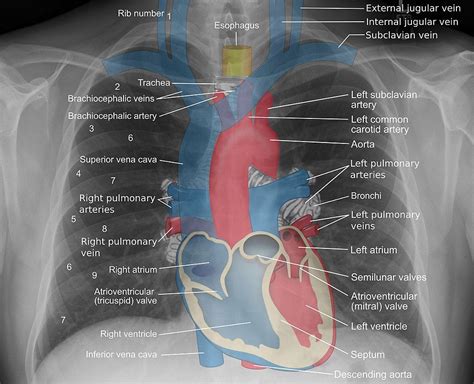 Central Venous Line Anatomy Central Venous Access Via Supraclavicular