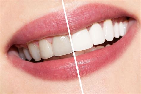 Teeth Smiles Dental Docs Moncton