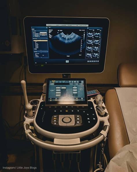 Pin By J Hernandez On Ob Sonographer Diagnostic Medical Sonography