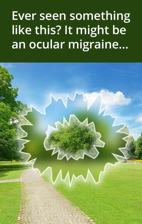 Ocular Migraines Explained Ocular Migraine Migraine Visual Migraine