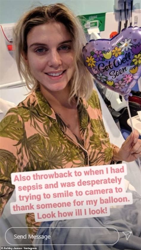 Pregnant Ashley James Shares Old Photo From When She Had Sepsis Daily Mail Online