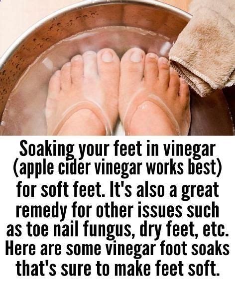 Apple Cider Vinegar Foot Soak For Soft Feet Foot Soak Vinegar Apple