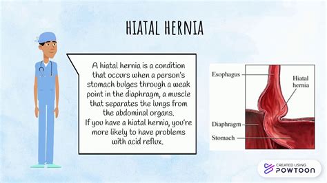 Types Of Hernias Youtube