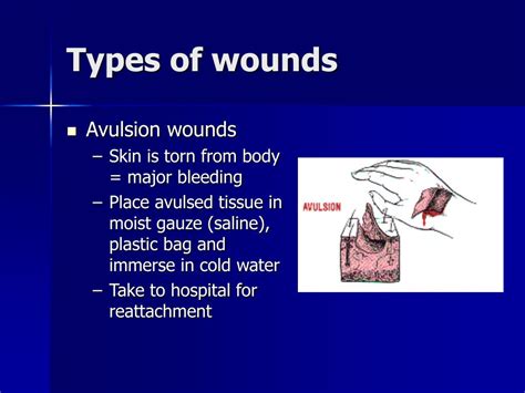 Ppt Wound Care Powerpoint Presentation Free Download Id6668159