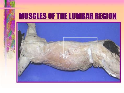 MUSCLES OF THE LUMBAR REGION