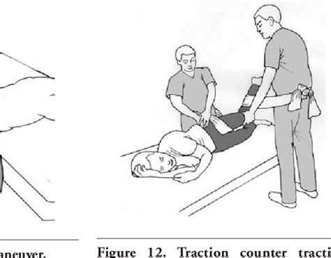 Pdf A Detailed Review Of Hip Reduction Maneuvers A Focus On