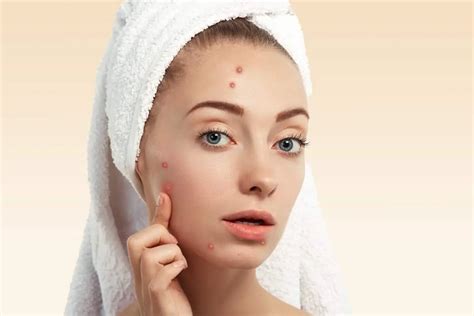 The Best Acne Skin Care Products And Treatment