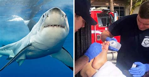 Shark Attack As Boy 11 Bitten By Creature With Human Like Teeth