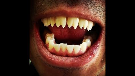 How To Get Vampire Teeth For Real Reverasite