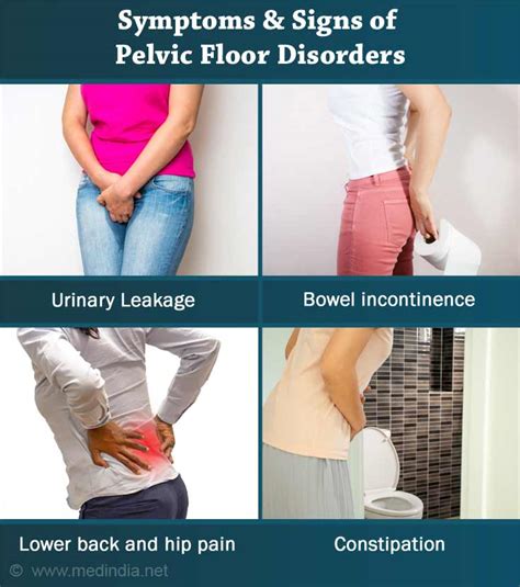 Pelvic Floor Disorders Causes Symptoms Diagnosis Treatment Prevention