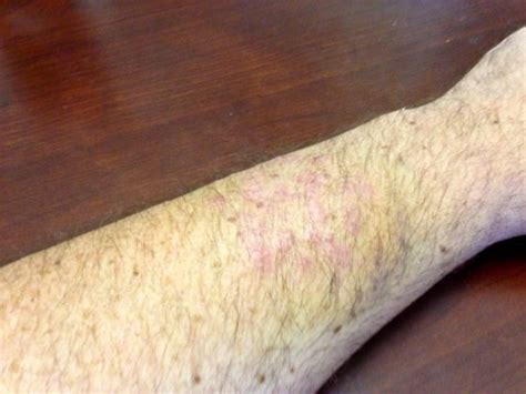 Cactus spines have many functions, from protection to the collection of vital water in dry climates, but some are so much harder to remove than others. Wildflower Dangers in the Grapevine Valley - DesertUSA ...