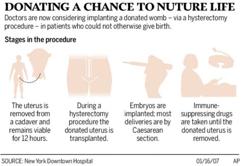 Uterus Transplant Plans Hold Hope For Barren Women Health And
