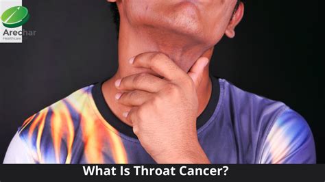 What Is Throat Cancer