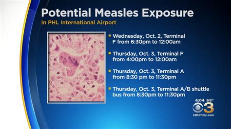 Health Officials Warning Passengers Of Measles Exposure At Philadelphia