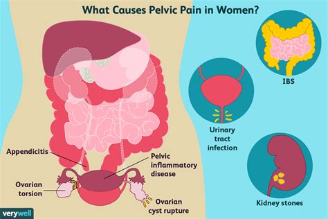 It can often be brief and not the pain can be described as dull and persistent. Pelvic Pain in Women: Causes and Treatment