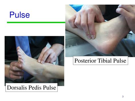 Dp Pulse Location The Dorsalis Pedis With Every One Other Bersamawisata