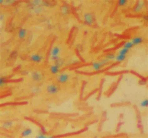 Bacillus Cereus Endospore Stain