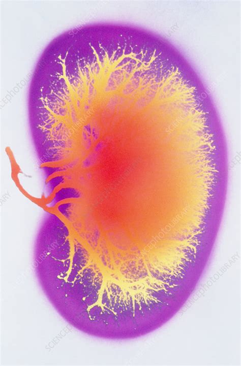 Coloured Angiogram Of Normal Human Kidney Stock Image P5500083